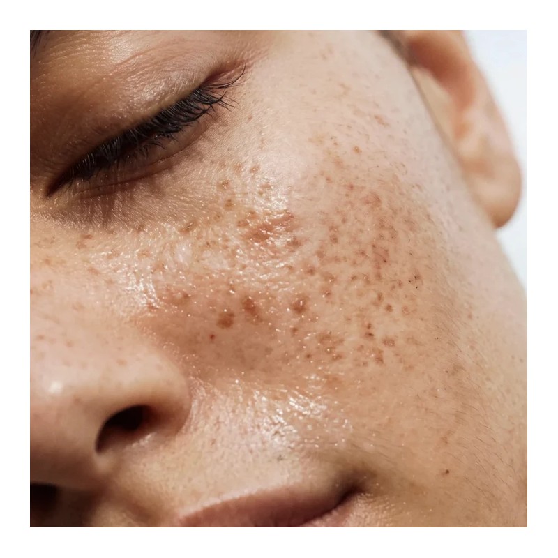 Honestly Clear Skin CÎME | Soins visage anti-imperfections