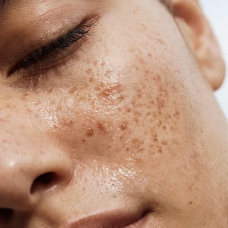 Honestly Clear Skin CÎME | Soins visage anti-imperfections